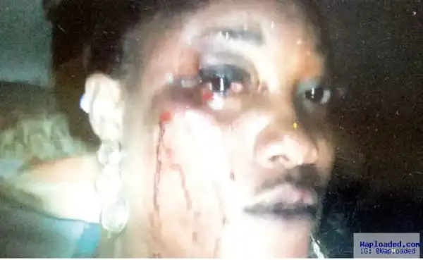 Court remands hairdresser, boyfriend for fighting over sex